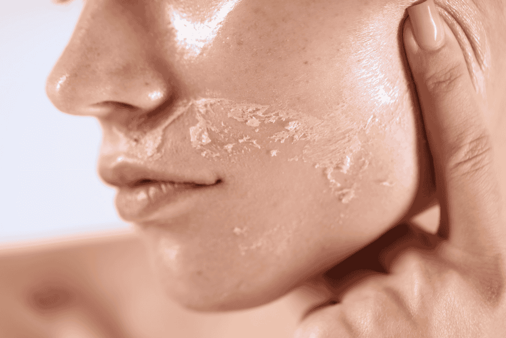 Sensitive Skin Remedies